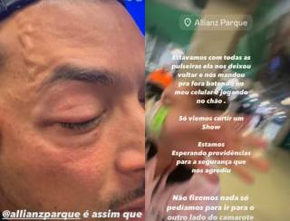 Deputado Felipe Franco diz que foi agredido por seguranças durante show de Chris Brown em São Paulo